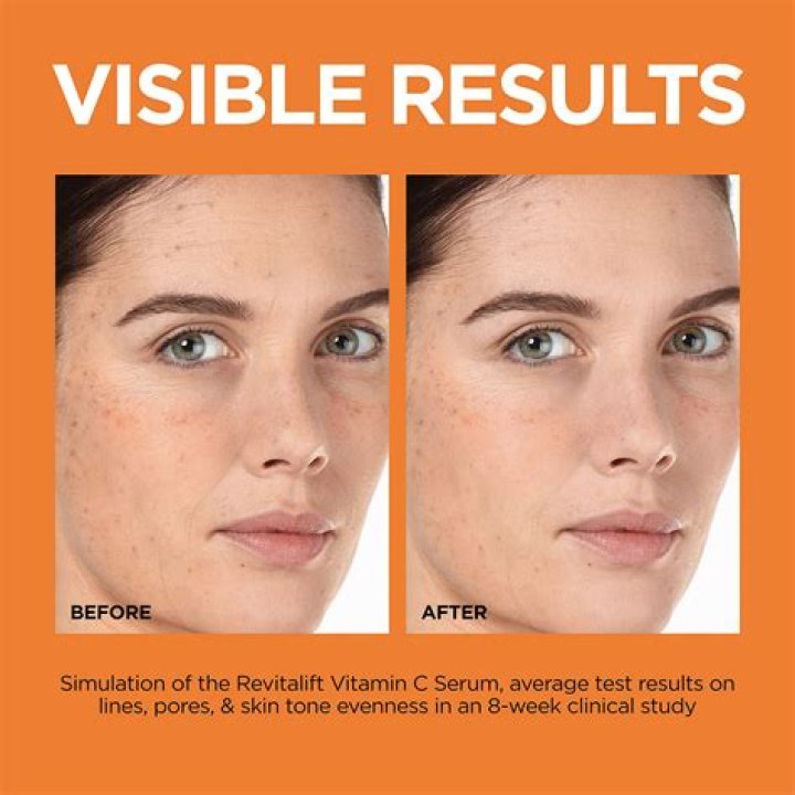 At what age should you start using vitamin C serum?