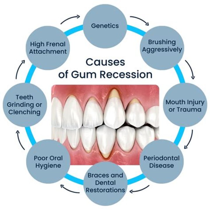 Can a dentist restore receding gums?