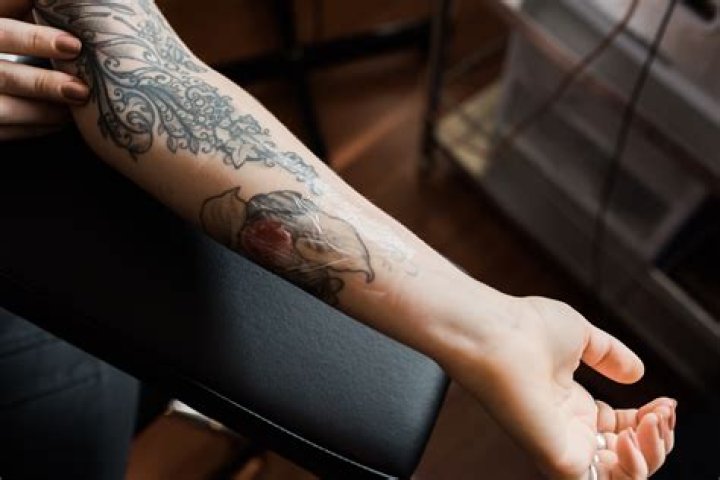 Can a tattoo go into shock?