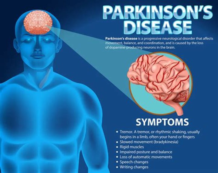 Can bupropion cause Parkinson's?