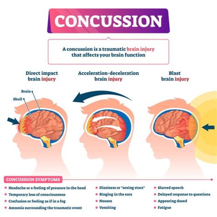 Can concussion symptoms show up 24 hours later?