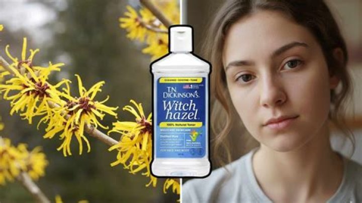 Can I clean my piercing with witch hazel?