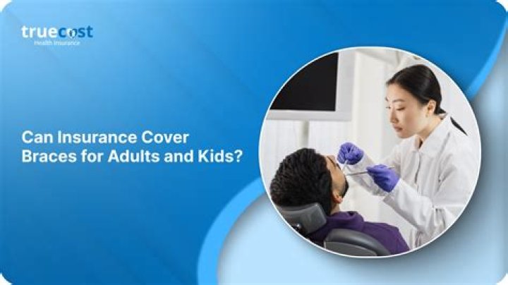Can insurance cover braces?