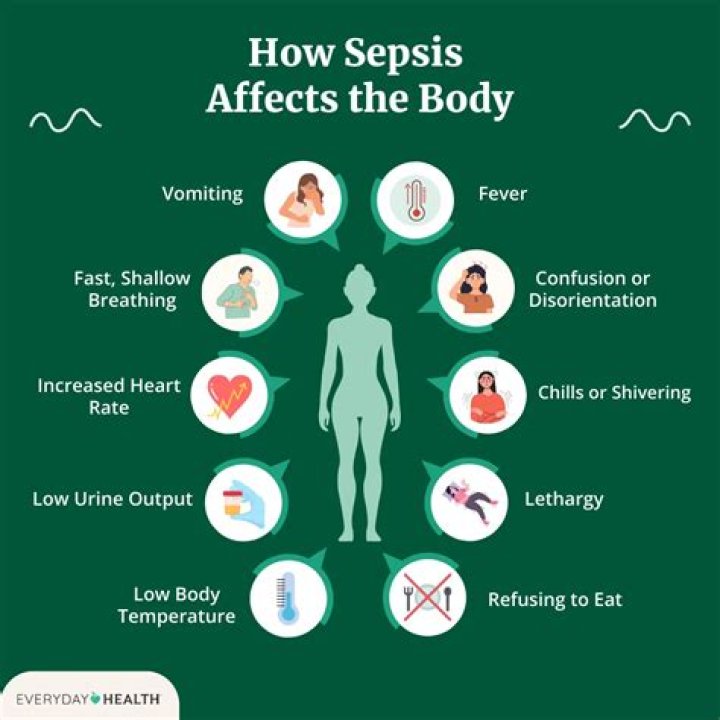 Can sepsis be cured completely?