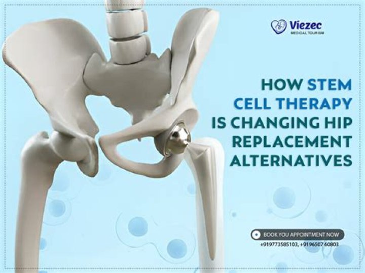 Can stem cell replace hip replacement?