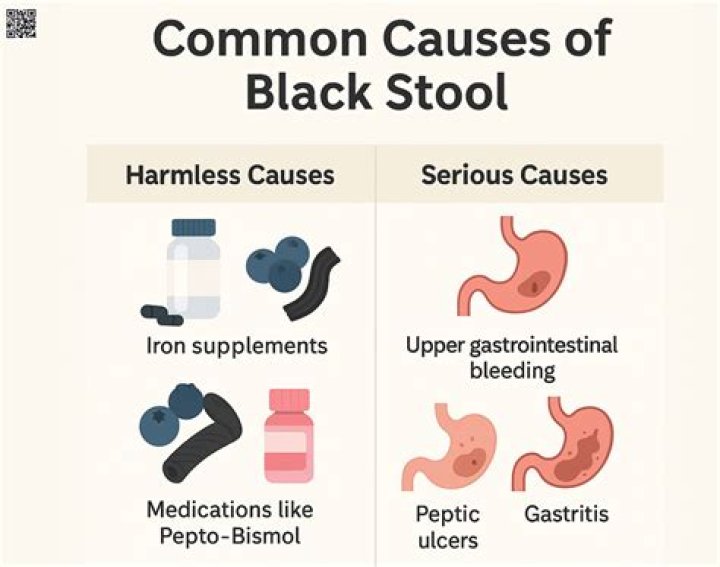 Can wine cause black stool?
