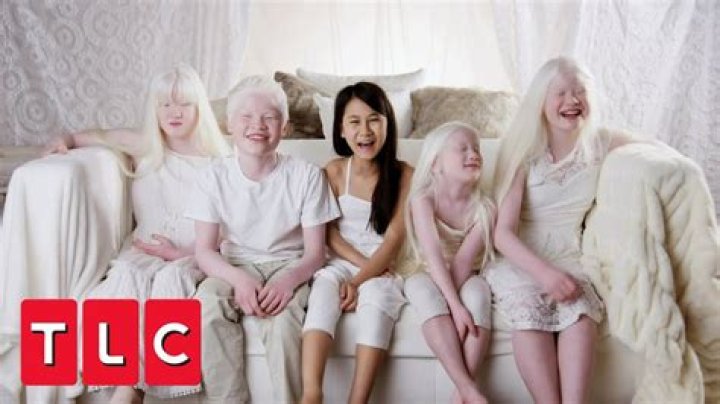 Can you be white and albino?