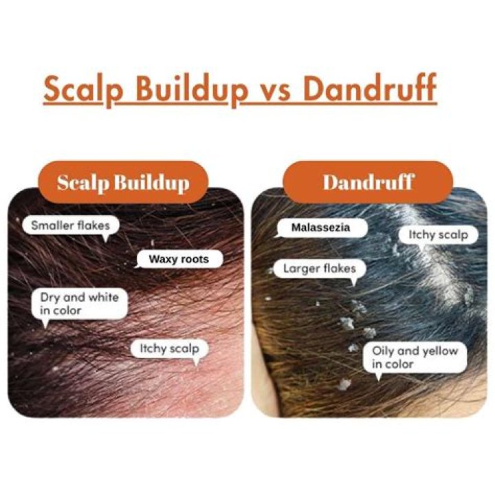 Does hard water cause scalp build-up?