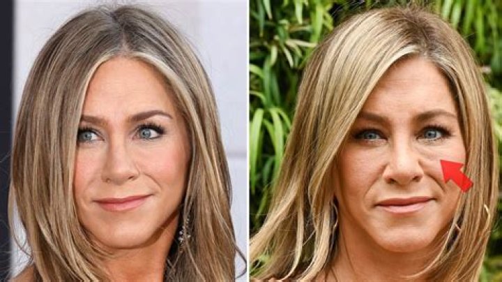 Does Jennifer Aniston use collagen?