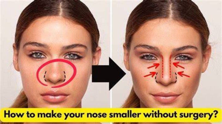 How can I straighten my nose naturally?