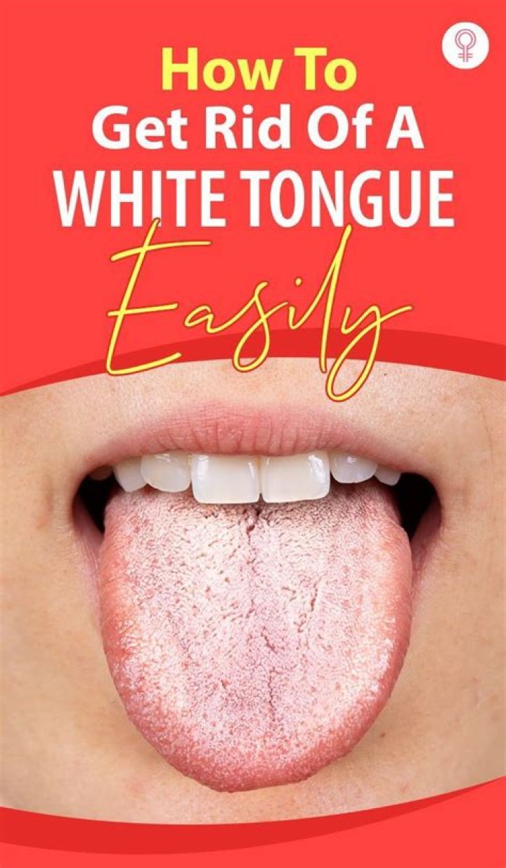 How do I get rid of a white tongue fast?