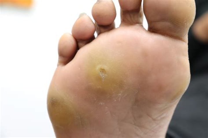 How do I get the feeling back in my foot?