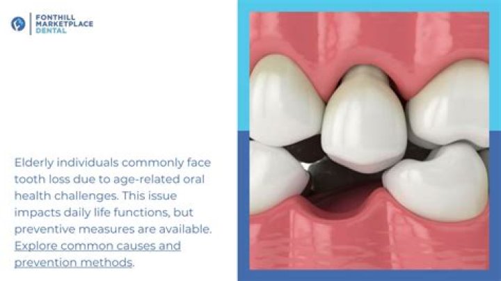 How do I stop my teeth from falling out?