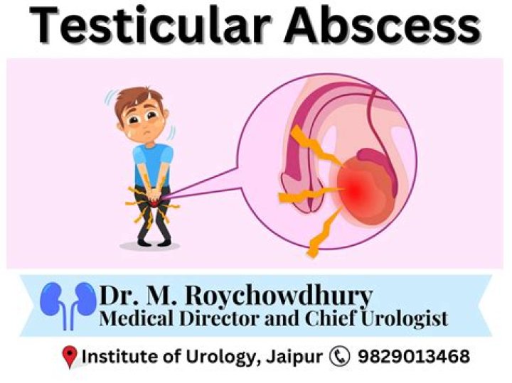 How do I treat a swollen testicle at home?