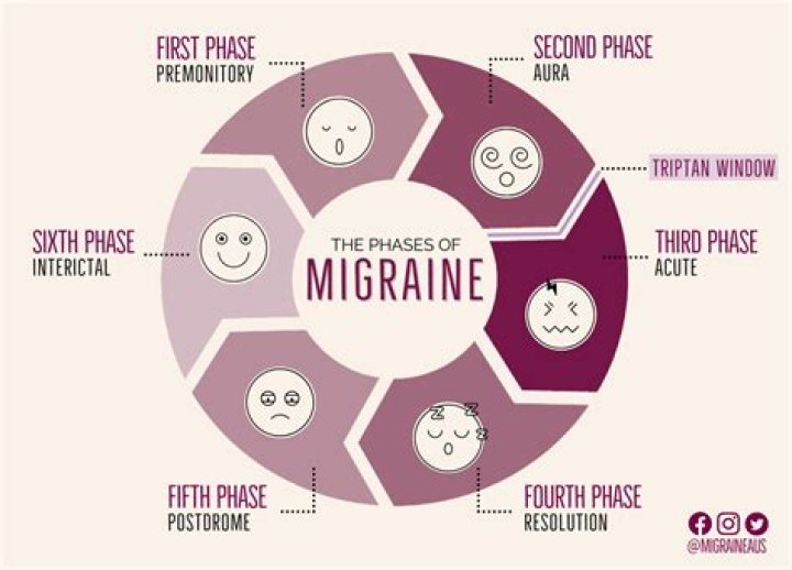 How do migraines start?