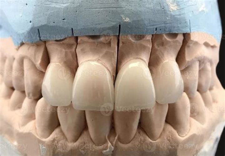 How do you mix dental gypsum?