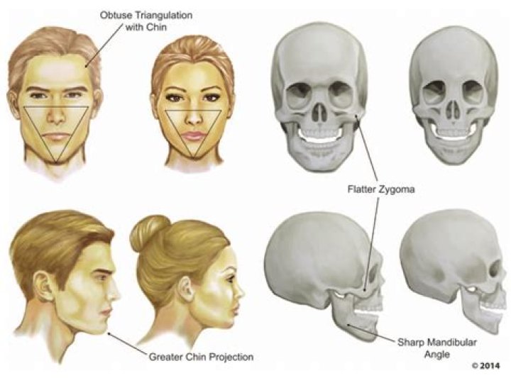How do you tell if you have protruding ears?