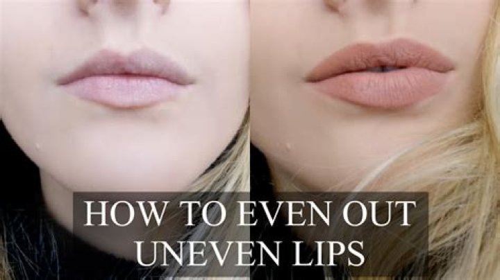 How do you treat uneven lip color?