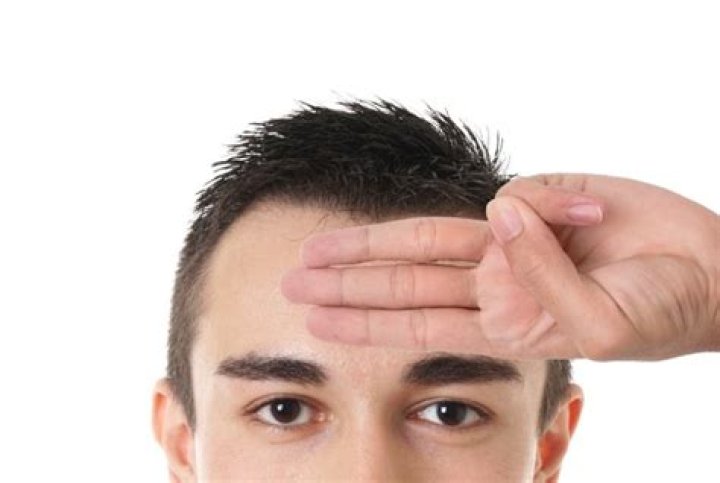 How many fingers is a big forehead?