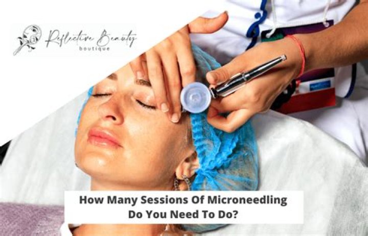 How many sessions of microneedling do you need?