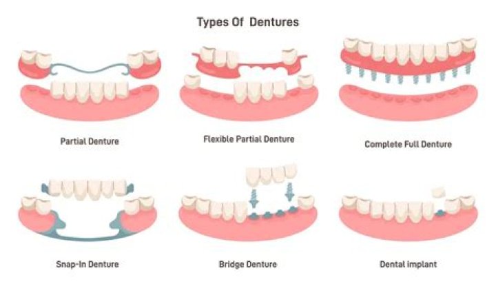 How painful are dentures?