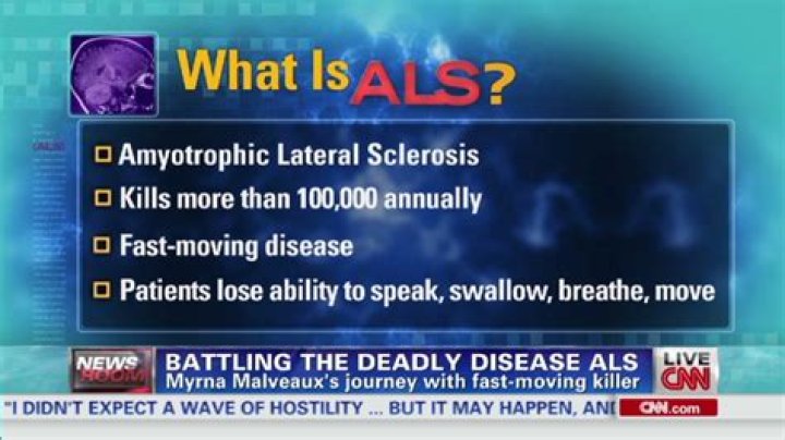 Is ALS always fatal?