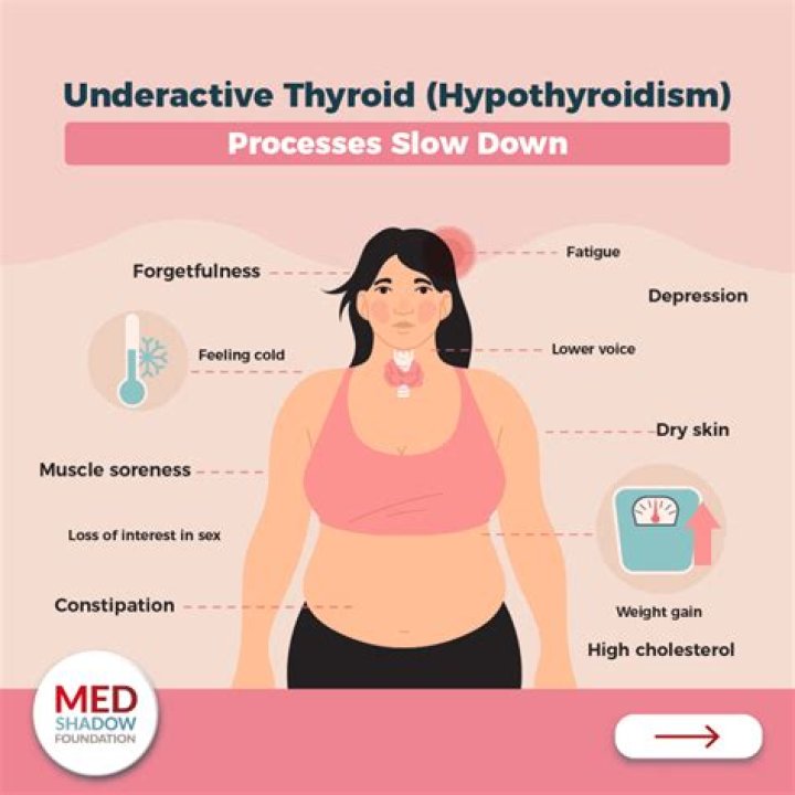 Is broccoli good for hypothyroidism?