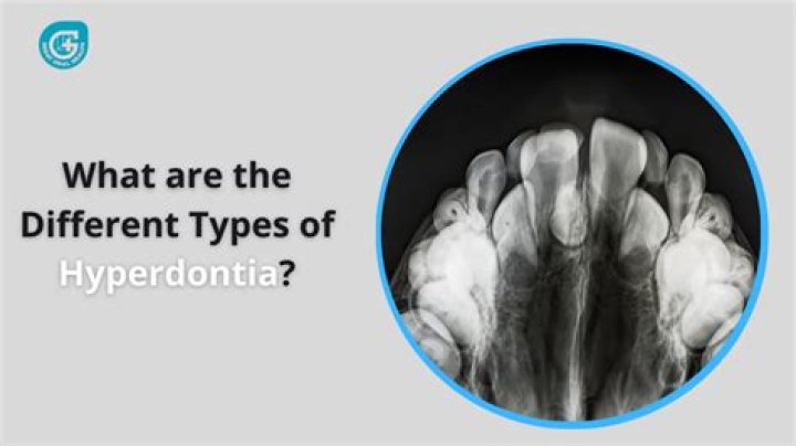 Is hyperdontia curable?