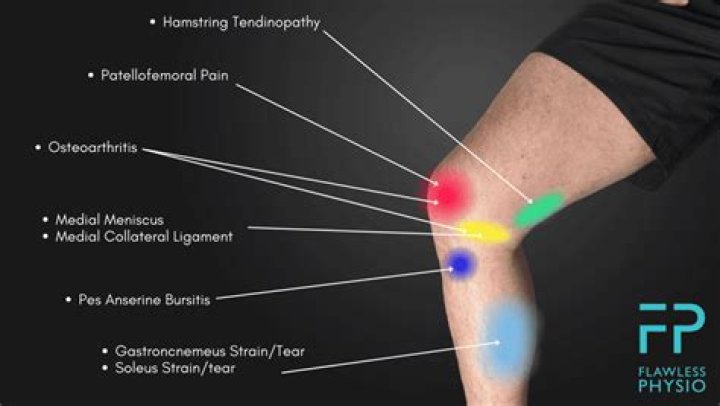 Should I rest a sore knee?