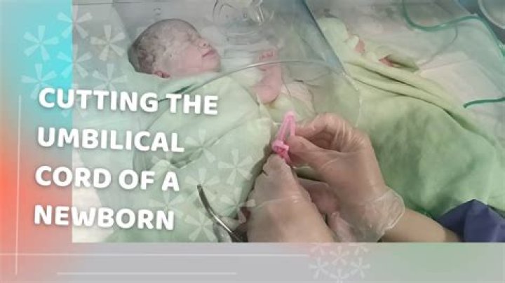 Should you immediately cut the umbilical cord?