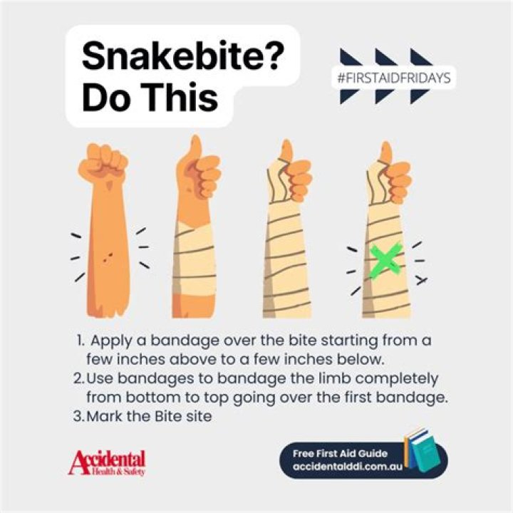 What are 4 things you should not do for a snake bite?