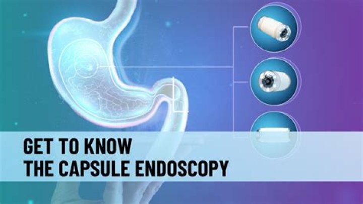 What are the disadvantages of a capsule endoscopy?