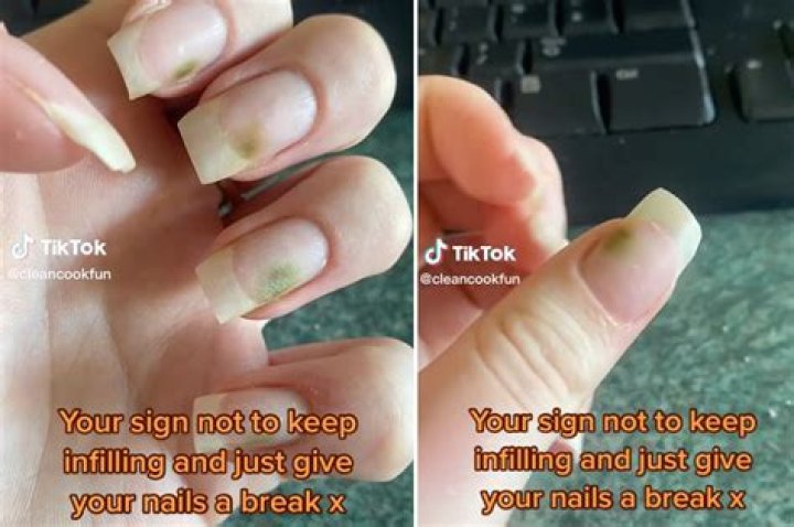 What causes acrylic nails to pop off?