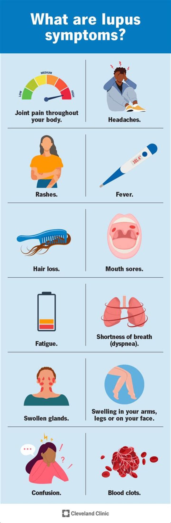 What does lupus do to the eyes?