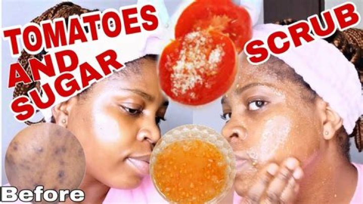What happens if we apply tomato and sugar on face?