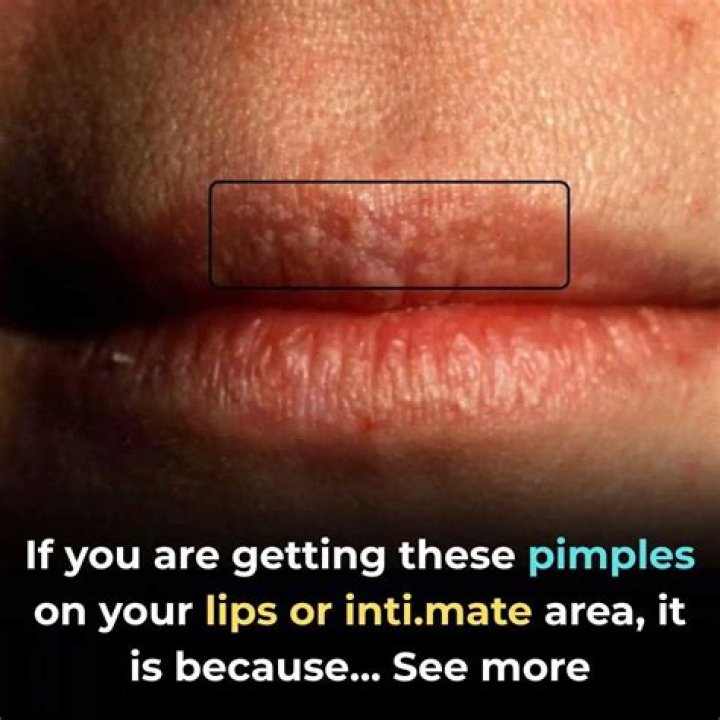 What happens when you rub lemon on your lips?