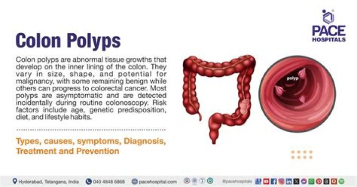 What is the average number of polyps removed in a colonoscopy?