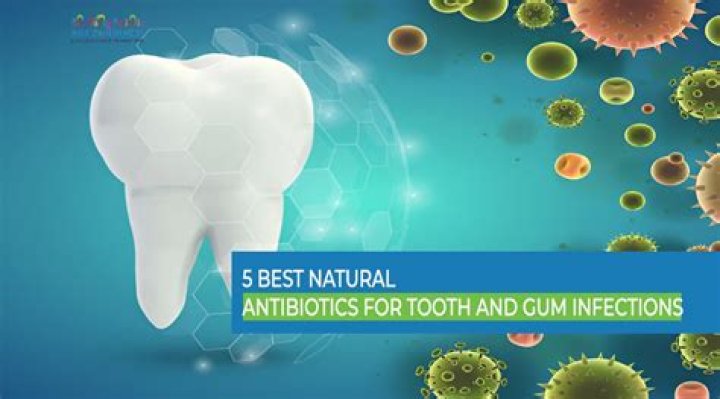 What is the best natural antibiotic for gum infection?