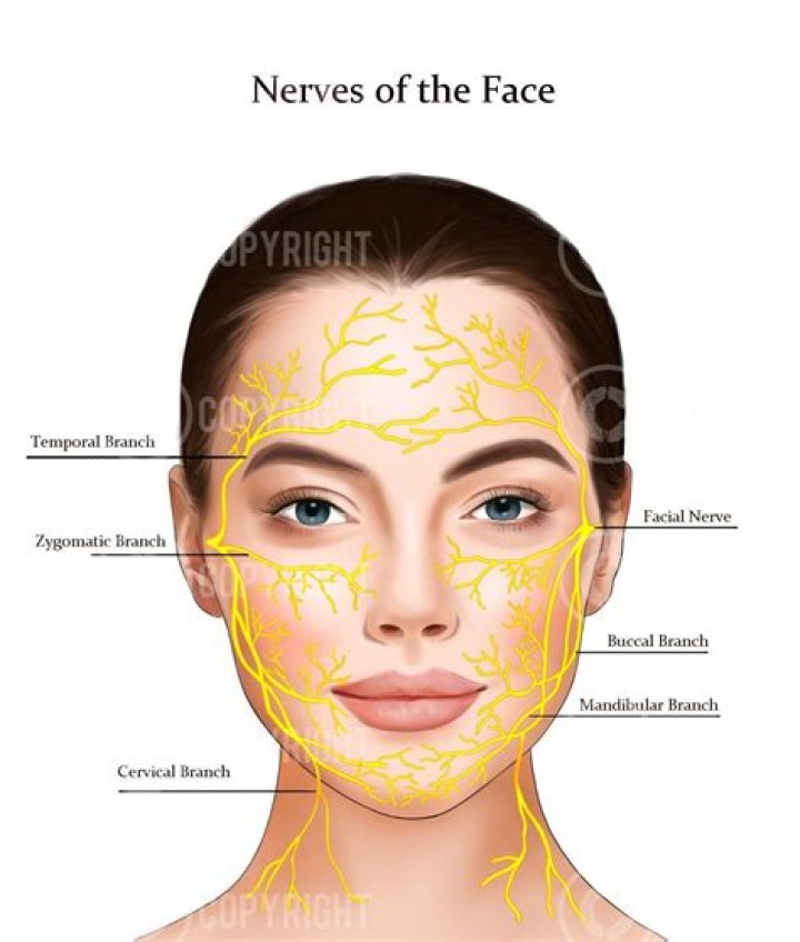 What nerves affect the face?