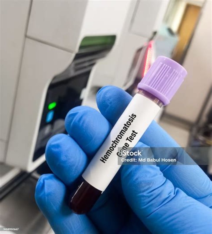 What should I eat if I have hemochromatosis?
