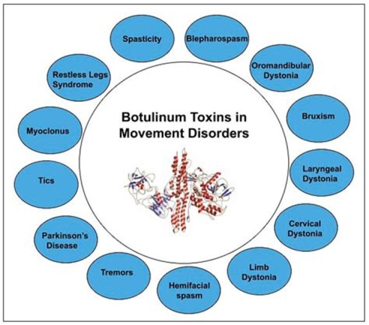 What temperature destroys botulinum toxin?