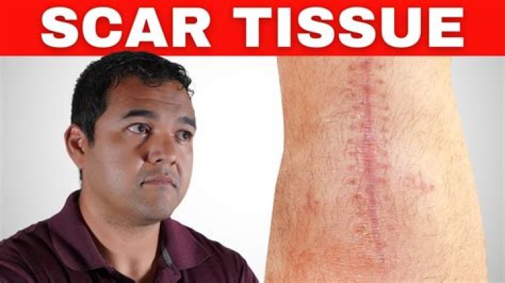 What test shows internal scar tissue?