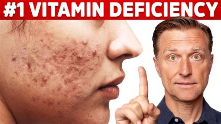 What vitamin Are you lacking when you have dry skin?