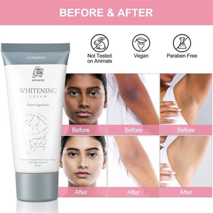 Which vinegar is best for skin whitening?