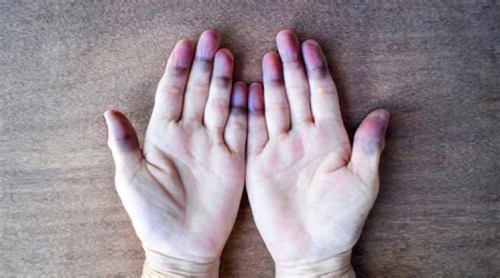 Why are my hands blue GREY?