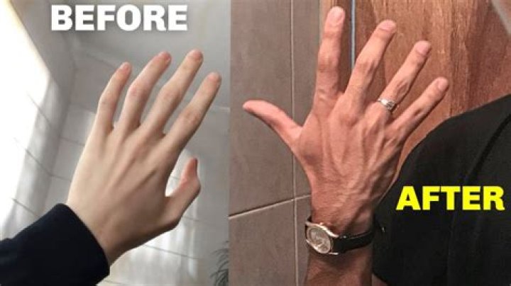 Why are my hands getting bigger?