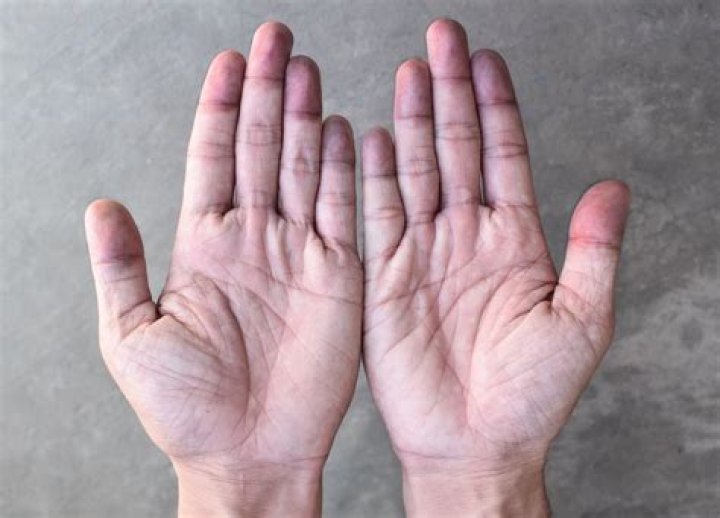 Why do my hands look GREY?