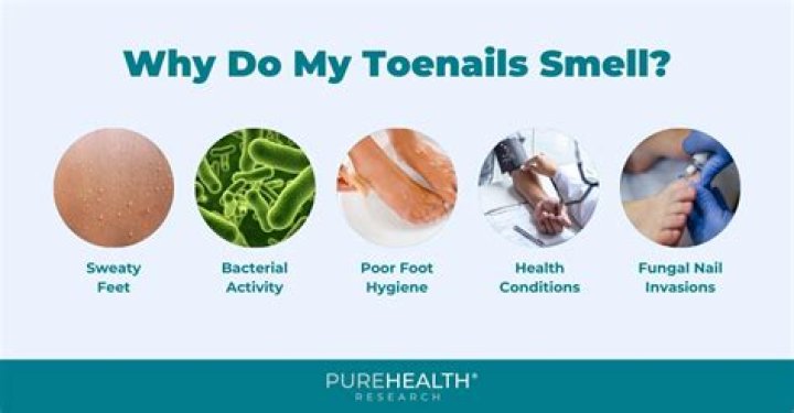 Why do my toenails smell?