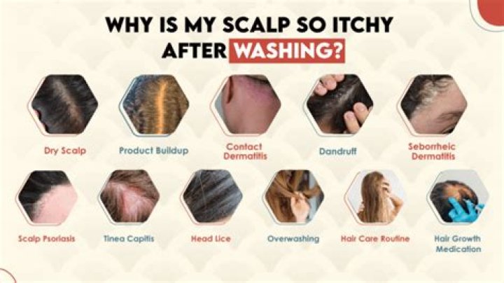 Why does my scalp itch if I don't wash my hair everyday?