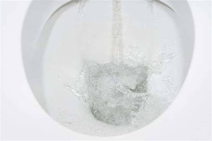 Why does toilet water turn brown after pooping?